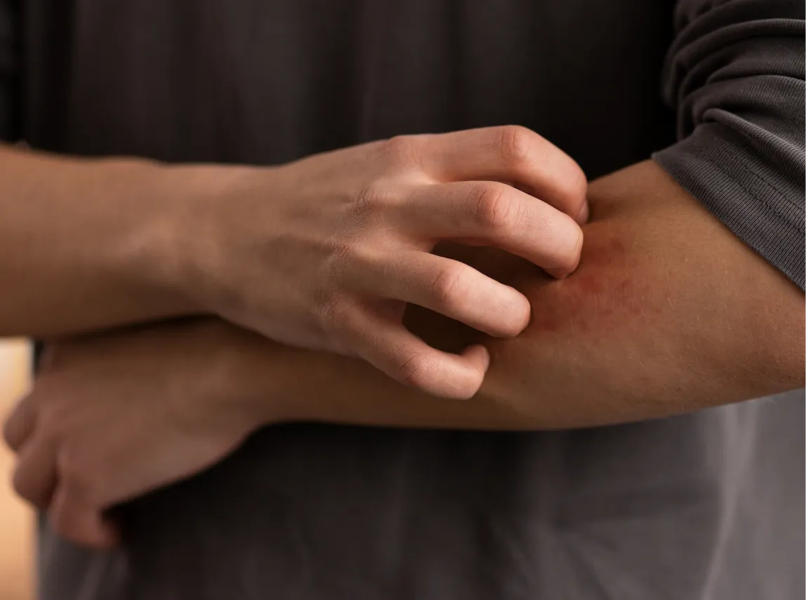 Office & Workplace Bed Bug Removal